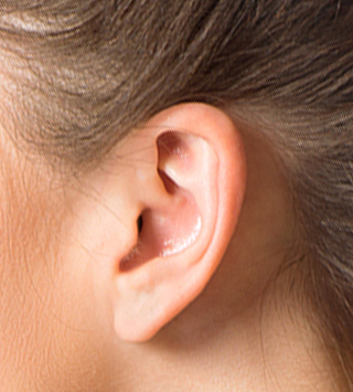 traitement-des-oreilles-docteur-hue-paris-versailles-médecine-esthétique-chirurgie-plastique-face-et-cou
